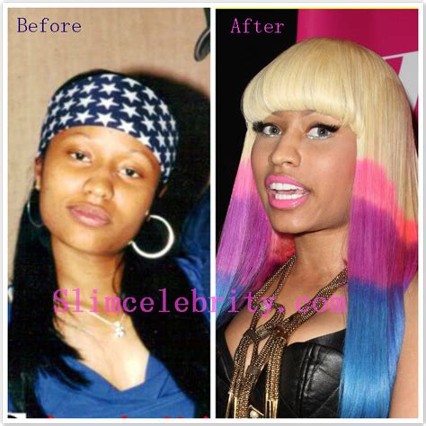 nicki minaj before and after pictures|nicki minaj surgery pictures.